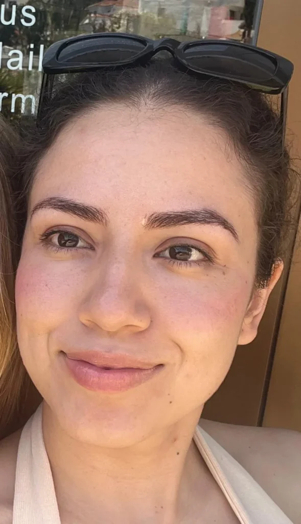 Resultado natural de un tratamiento de microblading realizado en Alex Beauty Harmony Marbella
